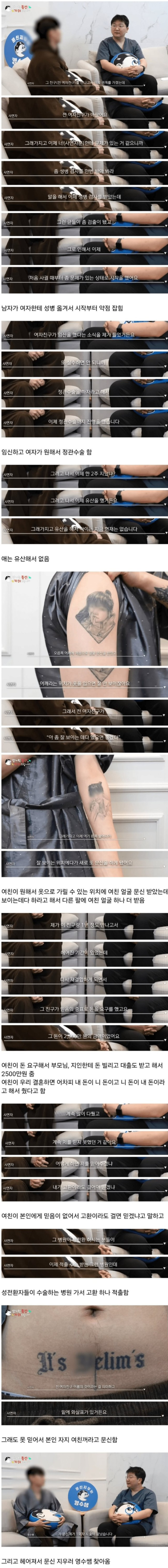 문신 지우러 온 이유 레전드