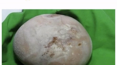 남자도 알을 낳을 수 있다