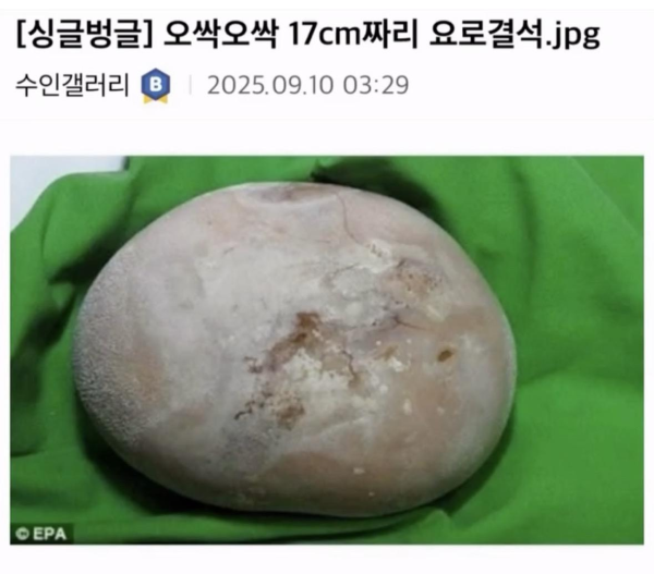 남자도 알을 낳을 수 있다