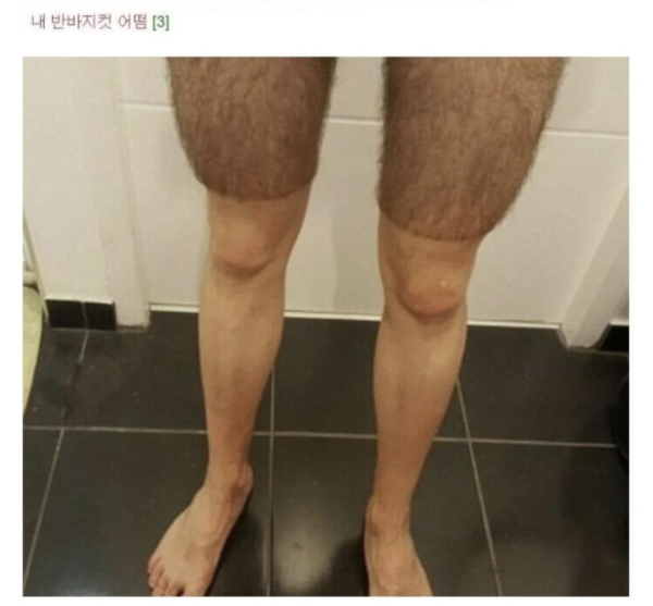 혐) 다리털 아티스트