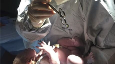 할로윈파티 하다가 응급수술 들어간 의사