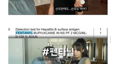 미국에서 출산 후에도 아프지 않은 이유