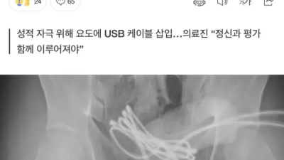 성적 쾌감 위해 벌인짓