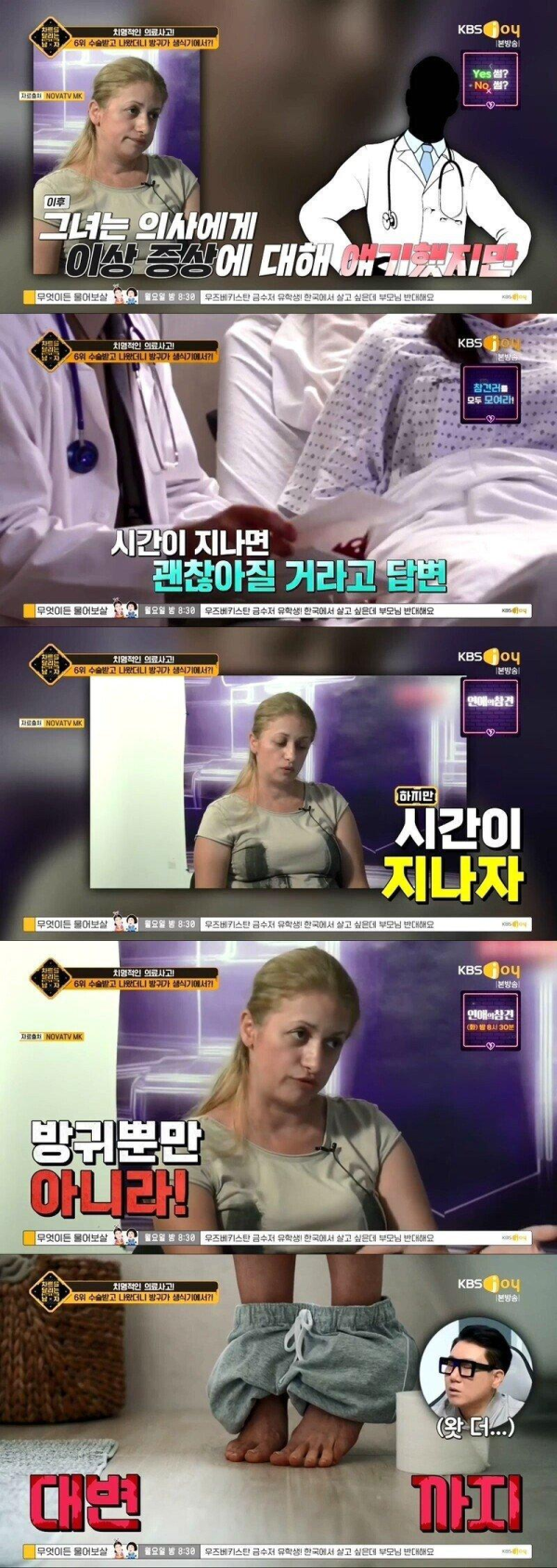 대장암 수술했더니 방귀가 생식기에서 나오는 여자