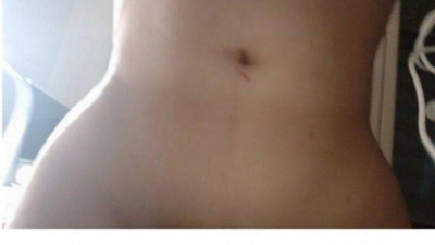 골반이 너무 커 고민인 디시인