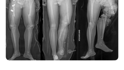 교통사고 났을 때 자세별 부상차이