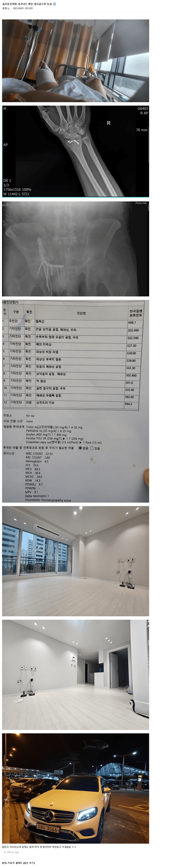 합의금으로 집이랑 벤츠 구매한 사람