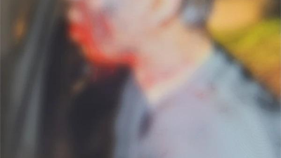 납치피해자 유튜버 수탉 구출 당시 사진